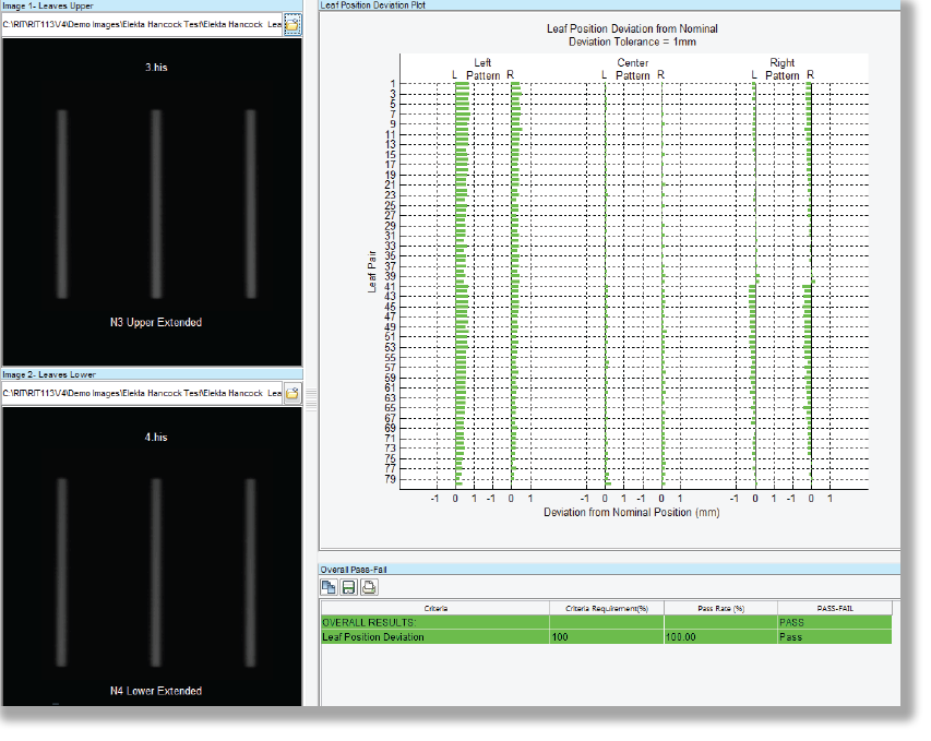 Elekta Hancock Tests