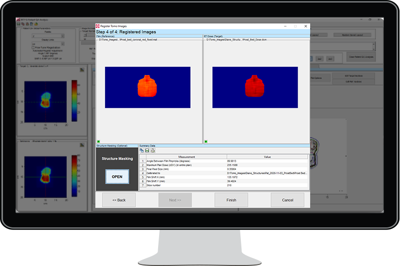 TomoTherapy Registration