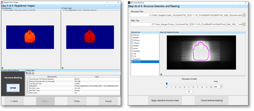 TomoTherapy Registration Structure Analysis