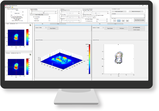 Patient QA with RIT Film